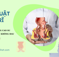 Phân loại bệnh trĩ và các phương pháp điều trị bệnh trĩ hiệu quả