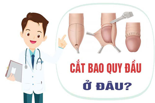 cắt bao quy đầu không đau Thuận An