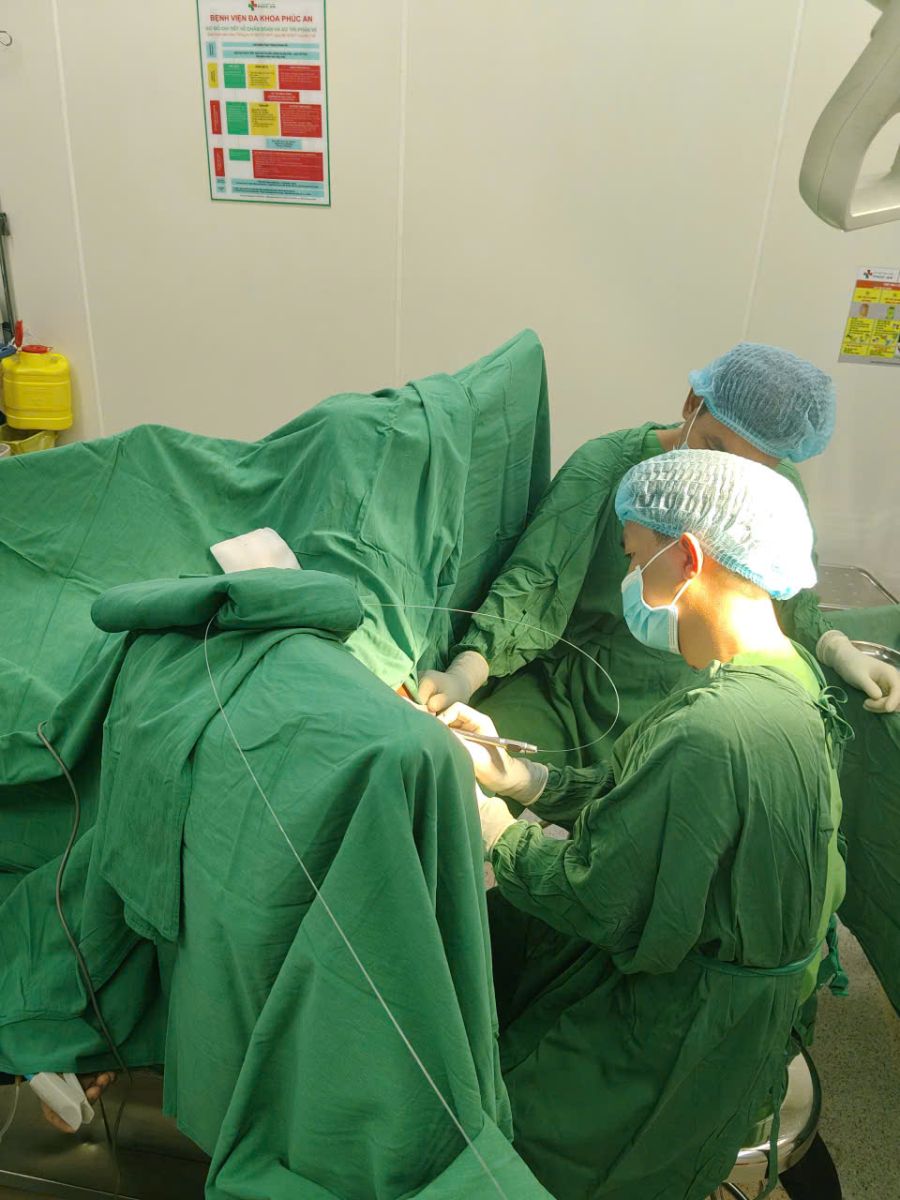 quy trình cắt trĩ laser